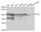Enhancer Of Zeste 2 Polycomb Repressive Complex 2 Subunit antibody, abx004158, Abbexa, Western Blot image 