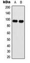 Eukaryotic Translation Elongation Factor 2 antibody, orb256505, Biorbyt, Western Blot image 