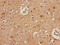 Aldehyde Dehydrogenase 5 Family Member A1 antibody, LS-C369223, Lifespan Biosciences, Immunohistochemistry paraffin image 