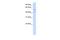 Leucine Rich Repeat Containing 23 antibody, A18100, Boster Biological Technology, Western Blot image 