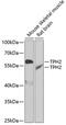 Tryptophan Hydroxylase 2 antibody, GTX03395, GeneTex, Western Blot image 