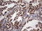 ATP Synthase Peripheral Stalk Subunit OSCP antibody, LS-C790314, Lifespan Biosciences, Immunohistochemistry paraffin image 