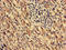 Mitochondrial Trans-2-Enoyl-CoA Reductase antibody, CSB-PA887132LA01HU, Cusabio, Immunohistochemistry frozen image 