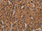 Ras antibody, CSB-PA981790, Cusabio, Immunohistochemistry paraffin image 