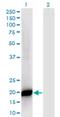 Protein Phosphatase 1 Regulatory Inhibitor Subunit 14B antibody, H00026472-M07, Novus Biologicals, Western Blot image 