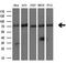 Leukotriene A4 Hydrolase antibody, GTX84176, GeneTex, Western Blot image 