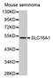 Solute Carrier Family 16 Member 1 antibody, MBS127108, MyBioSource, Western Blot image 
