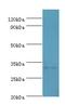 Solute Carrier Family 25 Member 15 antibody, LS-C380424, Lifespan Biosciences, Western Blot image 