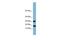 Trafficking Protein Particle Complex 2 Like antibody, GTX45017, GeneTex, Western Blot image 