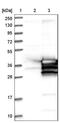Cilia And Flagella Associated Protein 298 antibody, NBP1-88276, Novus Biologicals, Western Blot image 