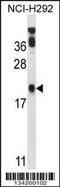 P53 Apoptosis Effector Related To PMP22 antibody, 57-777, ProSci, Western Blot image 