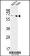 Ectonucleoside Triphosphate Diphosphohydrolase 1 antibody, LS-C167772, Lifespan Biosciences, Western Blot image 