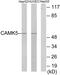 CaM Kinase Like Vesicle Associated antibody, PA5-38733, Invitrogen Antibodies, Western Blot image 