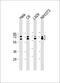 Lamin A/C antibody, M00438-4, Boster Biological Technology, Western Blot image 