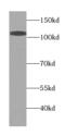 USO1 Vesicle Transport Factor antibody, FNab06058, FineTest, Western Blot image 