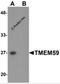 TMM59 antibody, 6063, ProSci Inc, Western Blot image 