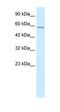 Transmembrane Protein 175 antibody, orb324530, Biorbyt, Western Blot image 