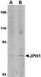 Junctophilin 1 antibody, PA5-20640, Invitrogen Antibodies, Western Blot image 