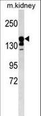 ATP Binding Cassette Subfamily C Member 9 antibody, LS-C160985, Lifespan Biosciences, Western Blot image 