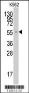 Phenylalanyl-TRNA Synthetase Subunit Alpha antibody, 62-996, ProSci, Western Blot image 