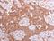 Pyrophosphatase (Inorganic) 1 antibody, GTX111031, GeneTex, Immunohistochemistry paraffin image 