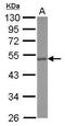 Corticotropin Releasing Hormone Receptor 1 antibody, GTX100180, GeneTex, Western Blot image 