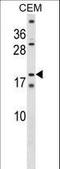 SSX Family Member 4B antibody, LS-C203703, Lifespan Biosciences, Western Blot image 