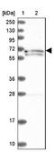 Hepatocyte Growth Factor antibody, NBP2-48724, Novus Biologicals, Western Blot image 
