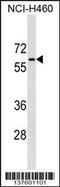 Phosphoglucomutase 5 antibody, 59-307, ProSci, Western Blot image 