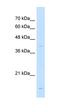 Lectin, Mannose Binding 2 antibody, orb325297, Biorbyt, Western Blot image 