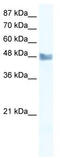 Mitogen-Activated Protein Kinase Kinase Kinase 8 antibody, TA329167, Origene, Western Blot image 