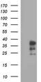 Interleukin-1 alpha antibody, M01144-1, Boster Biological Technology, Western Blot image 