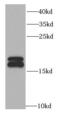 NME/NM23 Nucleoside Diphosphate Kinase 1 antibody, FNab05762, FineTest, Western Blot image 