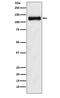 Natriuretic Peptide Receptor 2 antibody, M02251, Boster Biological Technology, Western Blot image 