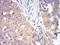 DEAD-Box Helicase 3 X-Linked antibody, NBP2-52457, Novus Biologicals, Immunohistochemistry paraffin image 