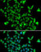 ASPA protein antibody, MBS2535470, MyBioSource, Immunofluorescence image 