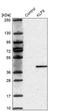 Integrin Subunit Alpha 5 antibody, NBP1-88507, Novus Biologicals, Western Blot image 