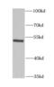 Glutamate dehydrogenase 1, mitochondrial antibody, FNab03498, FineTest, Western Blot image 