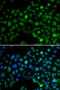 Nuclear Factor, Interleukin 3 Regulated antibody, STJ29433, St John