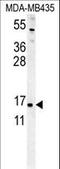 ENY2 Transcription And Export Complex 2 Subunit antibody, LS-C167778, Lifespan Biosciences, Western Blot image 