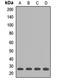 Glutathione S-Transferase Kappa 1 antibody, LS-C668616, Lifespan Biosciences, Western Blot image 