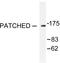 PTCH antibody, LS-C176173, Lifespan Biosciences, Western Blot image 