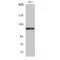 Hexokinase 1 antibody, LS-C384056, Lifespan Biosciences, Western Blot image 
