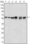 AKT Serine/Threonine Kinase 2 antibody, GTX83257, GeneTex, Western Blot image 