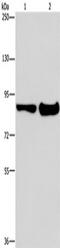 Endothelin Converting Enzyme 1 antibody, TA349913, Origene, Western Blot image 