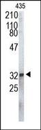 Proteasome Subunit Alpha 1 antibody, 200179, Abbiotec, Western Blot image 