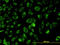 Acyl-CoA Thioesterase 9 antibody, LS-B4522, Lifespan Biosciences, Immunofluorescence image 