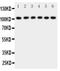 Nuclear Factor Kappa B Subunit 1 antibody, PA2111, Boster Biological Technology, Western Blot image 