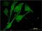 Membrane Bound Transcription Factor Peptidase, Site 2 antibody, H00051360-M01, Novus Biologicals, Immunofluorescence image 