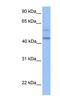 Programmed Cell Death 2 Like antibody, NBP1-79403, Novus Biologicals, Western Blot image 